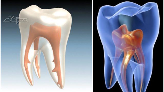 endodonția 3D